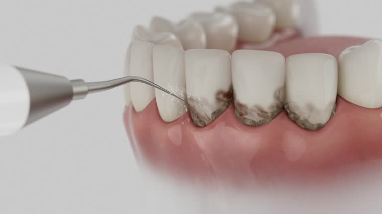 Reliable Dental contractor in Filer, ID by Smile Center Dentistry